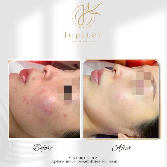 Jupiter Review (39)