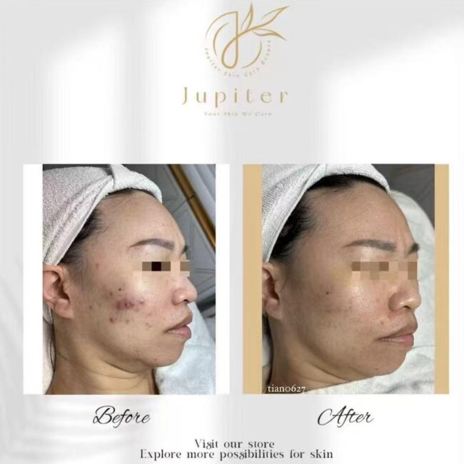 Jupiter Review (40)