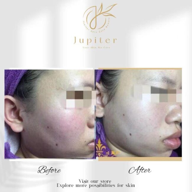 Jupiter Review (50)