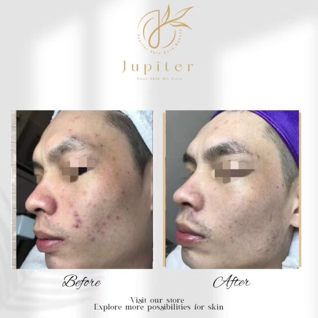 Jupiter Review (67)