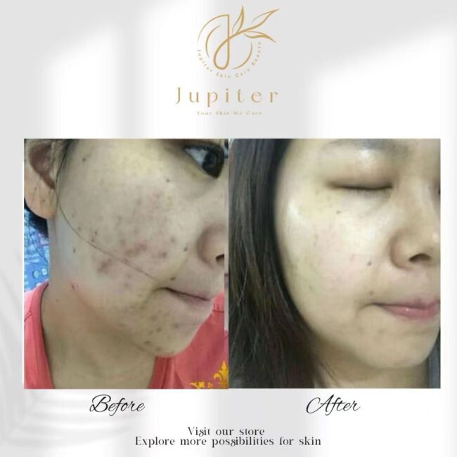 Jupiter Review (68)