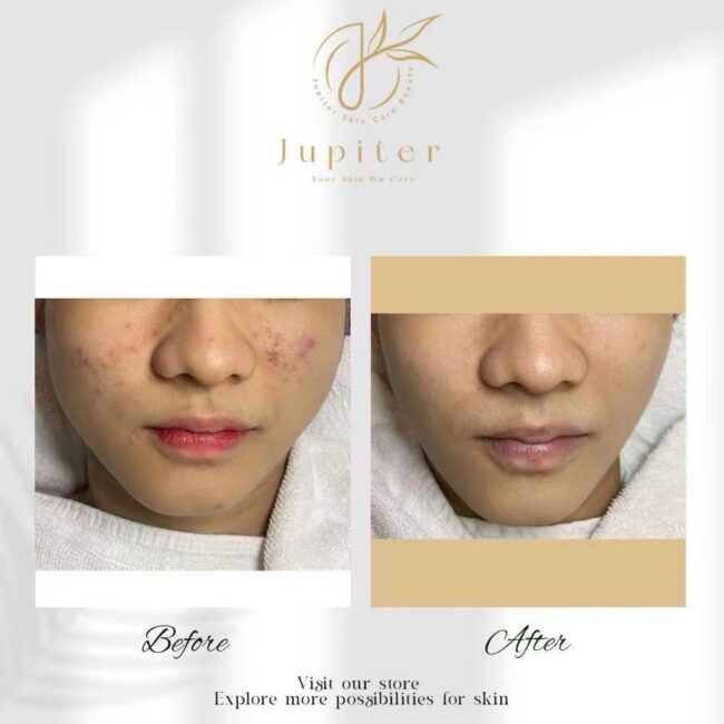 Jupiter Review (69)