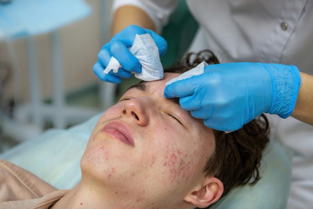 Stop Acne & Breakouts - Best Facial Treatment for Acne JB - Jupiter Skin Care