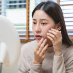 Stop Guessing Your Skincare - Tailored Acne Treatment KL - Jupiter Skin Care